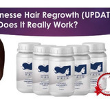Voluminesse%20hair%20regrowth